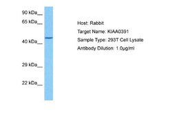 Mitochondrial ribonuclease P protein 3 Rabbit anti-Human, Polyclonal, Novus